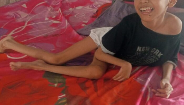 Warga Difabel di Blang Bintang Terabaikan, Tiga Tahun Tak Tersentuh Bantuan Pemerintah