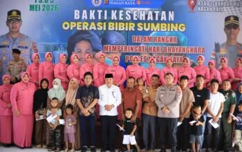 Bupati TRK Apresiasi Operasi Bibir Sumbing Gratis di Nagan Raya pada Hari Bhayangkara ke-80