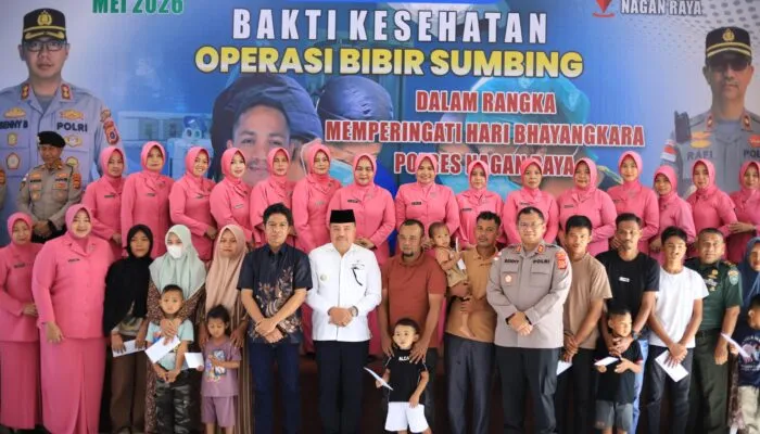 Bupati TRK Apresiasi Operasi Bibir Sumbing Gratis di Nagan Raya pada Hari Bhayangkara ke-80